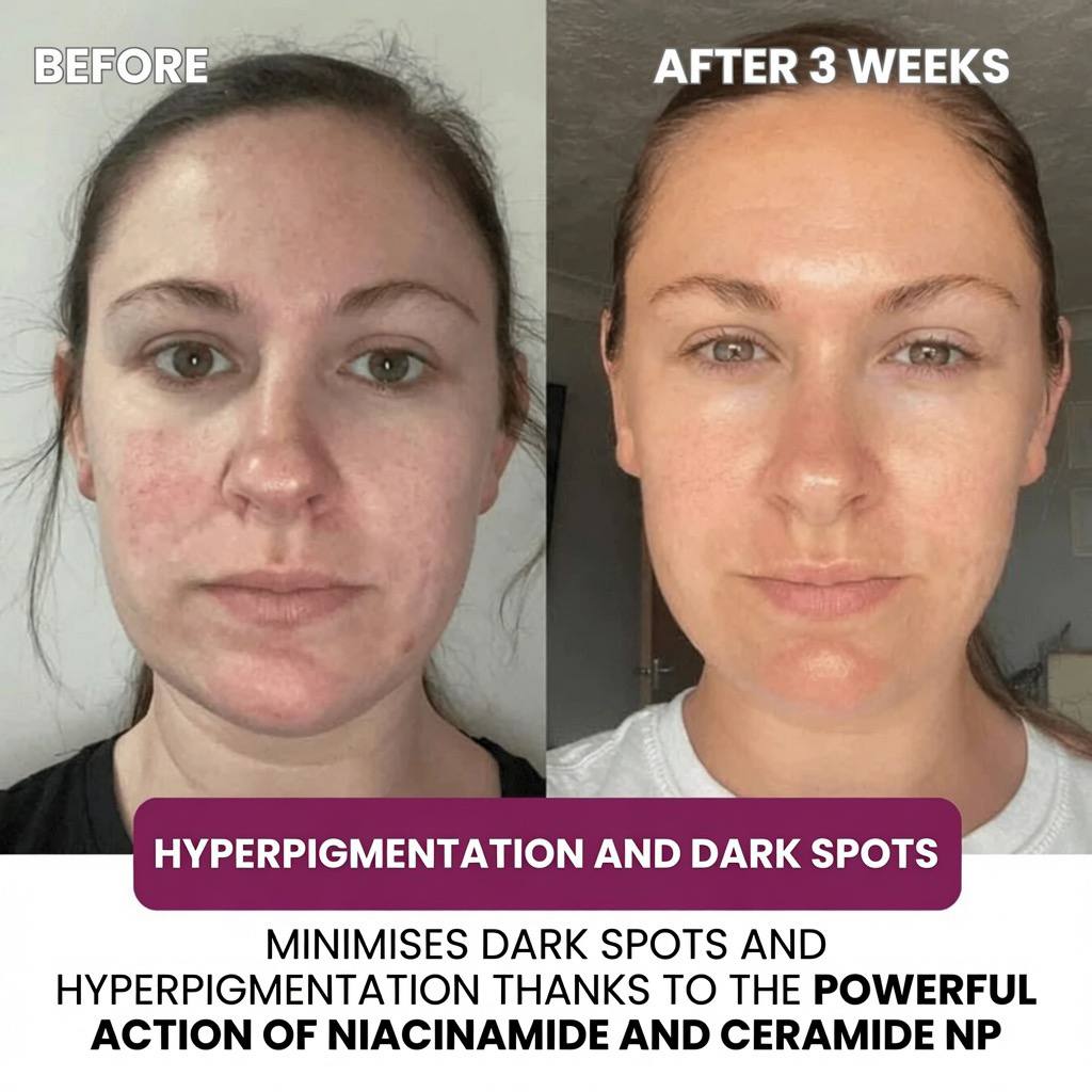 Collagen and Niacinamide Repairing Mask